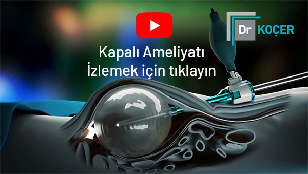 Kapalı Ameliyat Videosu